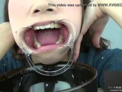 Teeth fetish